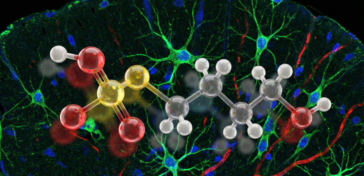 Lotta all’Alzheimer: interessanti passi avanti Lotta all’Alzheimer: interessanti passi avanti