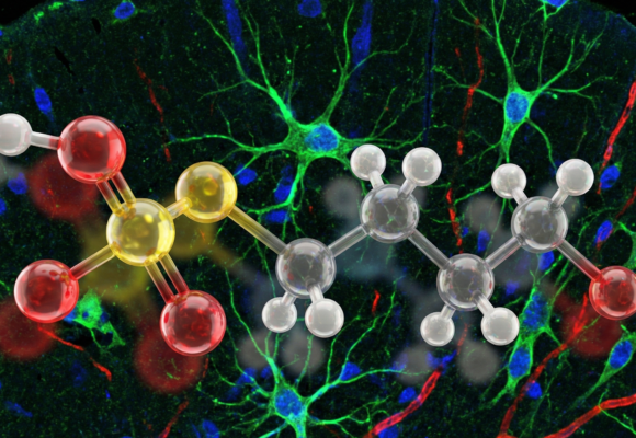 Lotta all’Alzheimer: interessanti passi avanti